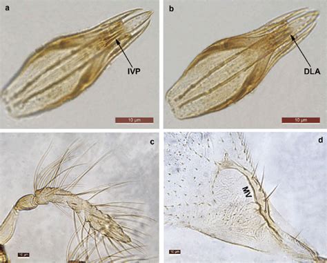 Trichogramma Soberania Sp Nov Holotype Male A Genitalia Ventral Download Scientific