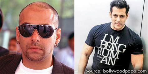 Did Salman Khan Undergo Hair Transplantation Surgery?