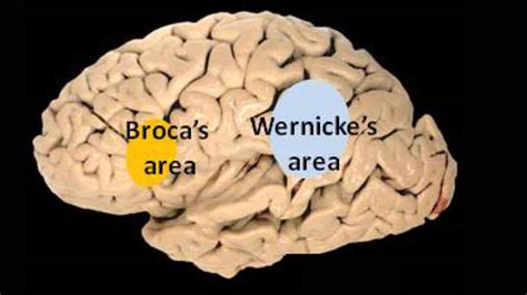 What is Wernicke's Area