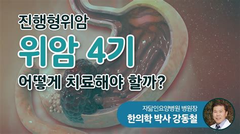 진행형위암 위암 4기 어떻게 치료해야 할까 Youtube