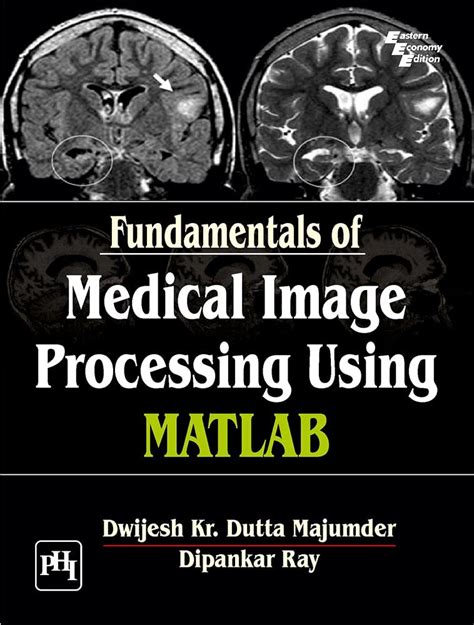 Fundamentals Of Medical Image Processing Using MATLAB Amazon Co Uk