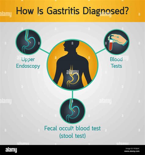 Vectores De Gastritis Vectores Fotografías E Imágenes De Alta