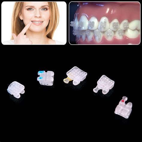 Ormaer M Dental Orthodontic Ceramic Brackets Roth Mbt Slot