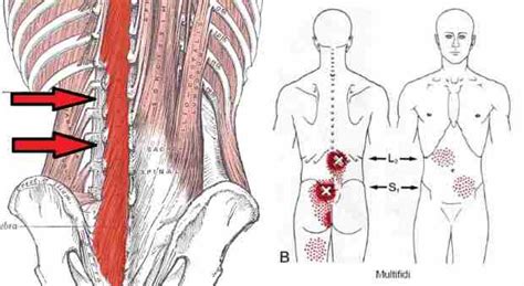 Fisioterapia En La Lumbalgia Anatom A De Los M Sculos Mult Fidos