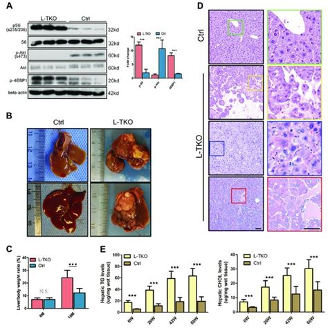 L Tko Mice Spontaneously Developed Hcc With Lipid Accumulation L Tko