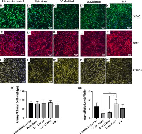 Confocal Micrographs Of Primary Rat Schwann Cells Immunolabeled For