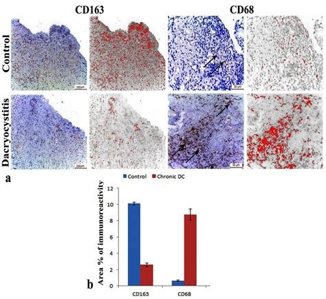 A Representative Figures Of Cd163 And Cd68 Immunohistochemistry And Download Scientific