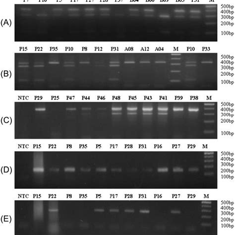 Gel View For Molecular Methods For Sex Identification Using Post Mortem Download Scientific