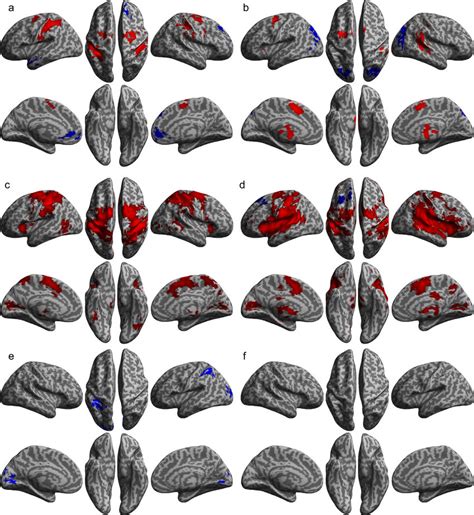 Brain Regions Showing Significant Activation Change As A Function Of