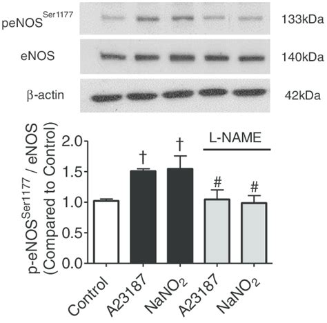 Levels Measured By Western Blotting Of Phosphorylated Enos At Ser1177 Download Scientific