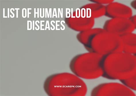 Human Blood Diseases List and Blood problems that influence Red Blood ...