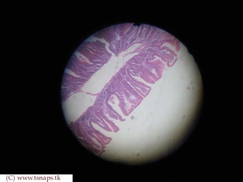 Histology Slides Database: simple columnar epithelium histology slide