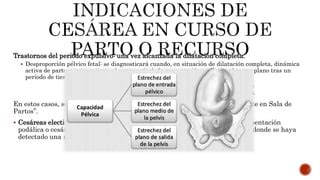 Indicaciones Cesarea Ppt