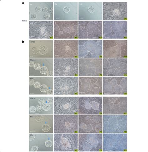 a Derivation of human embryonic stem cell lines MAN lines 10–16 from ... 