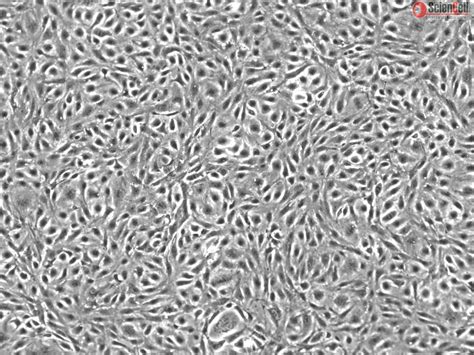 Human Adipose Microvascular Endothelial Cells Passage 1