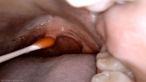 Uvula Cholula Direct Hot Sauce Application With Swab Wmv Strangecares Clips Sale