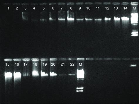 Representative results from gel electrophoresis analysis of genomic DNA... | Download Scientific ...