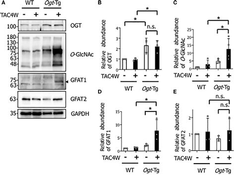 Frontiers O Glcnacylation Induced Gsk 3β Activation Deteriorates