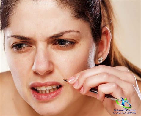 موهای زائد صورت و بدن را چگونه از بین ببریم؟ طب بوعلی سینا سلامت وب طب بوعلی سینا