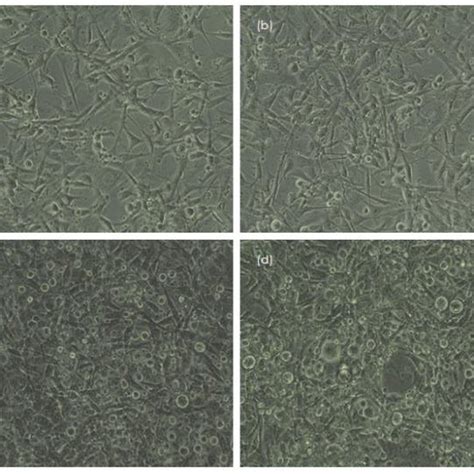 The Morphology Of The Human Breast Cancer Cell Mda Mb 231 Acontrol