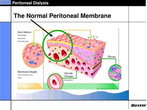 Ppt Anatomy And Physiology Of Peritoneal Dialysis Powerpoint