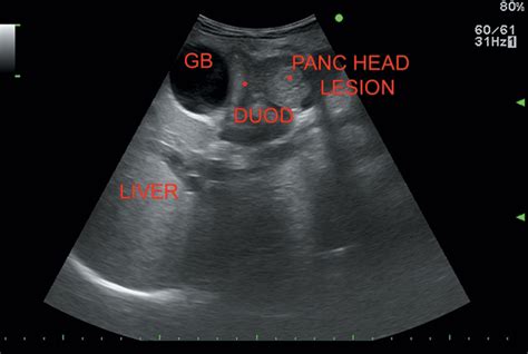 Pancreas Radiology Key