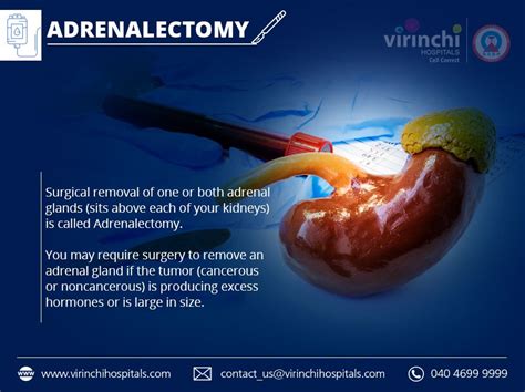 Adrenalectomy Adrenal Glands Adrenals Endocrine