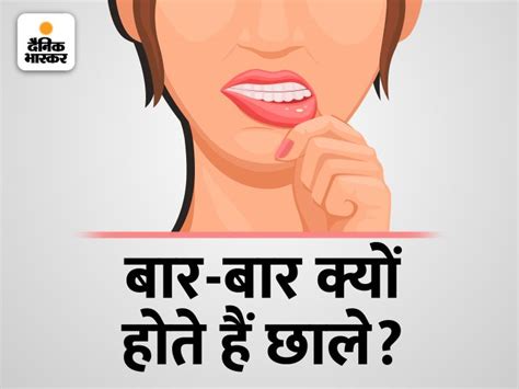 Mouth Ulcer Treatment Causes Symptoms And Home Remedies All You