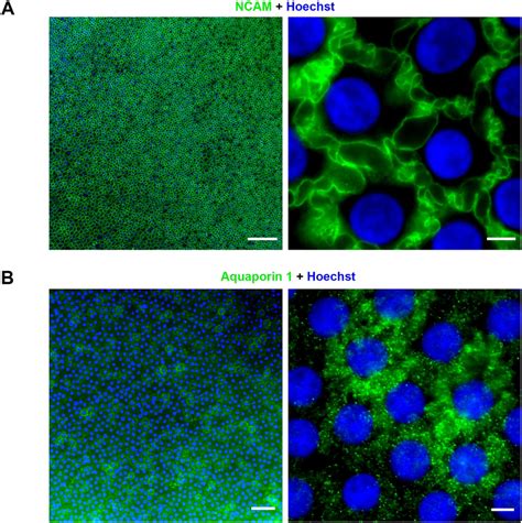 Grading Of Immunostaining Of Human Corneal Endothelial Cells Cecs Download Scientific Diagram