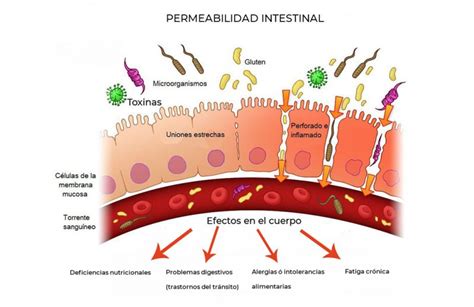 Aumento De La Permeabilidad Intestinal Dra Marta Aguirre