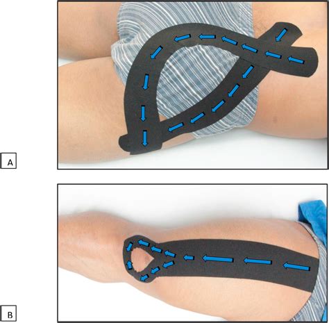 The Effect Of The Kinesio Tape On The Muscle Power Performance Of Elite