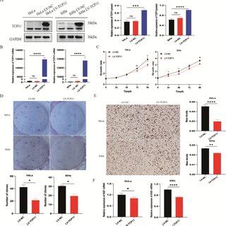 TCP11 Overexpression Blocks Cell Cycle Progression In HeLa And SiHa