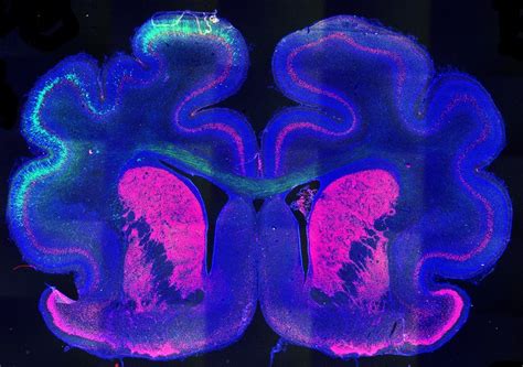 Mecanismo Para Que Se Produzcan Pliegues En La Corteza Cerebral