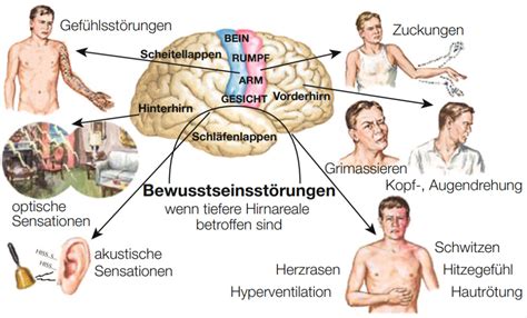 Epilepsie nach Schlaganfall Ursache für Anfälle und Therapie