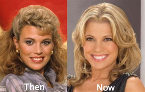 Vanna White Plastic Surgery Before and After Photos