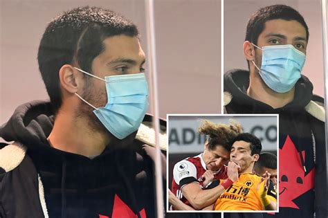raul jimenez shows  shocking head scar  wolves stands  everton
