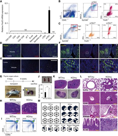 Fezf Orchestrates A Thymic Program Of Self Antigen Expression For