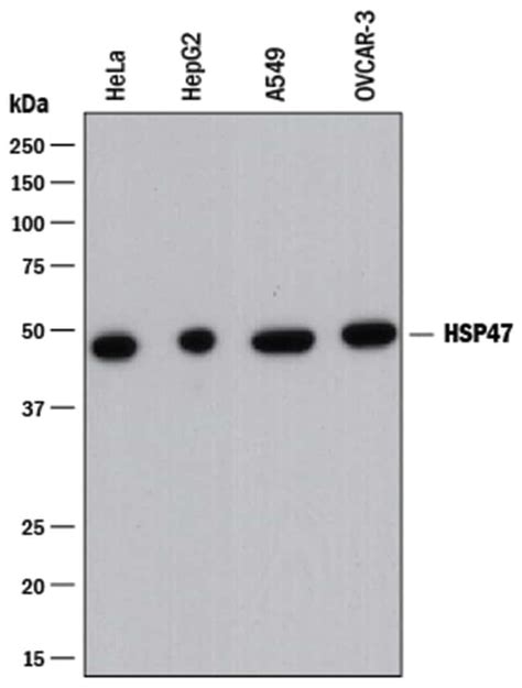 Hsp47 Mouse anti Human Clone 950811 R D Systems 25μg Unlabeled