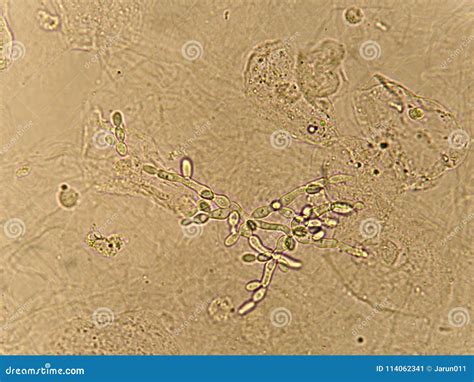 Pseudohyphae And Budding Yeast Cells Stock Image Image Of Health