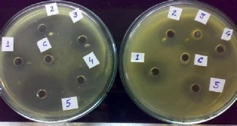 F Figure Plates Showing Zone Of Inhibition By Different Antibiotics