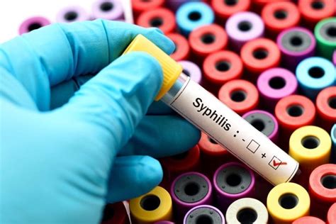 Syphilis - Symptoms and Treatment | familydoctor.org