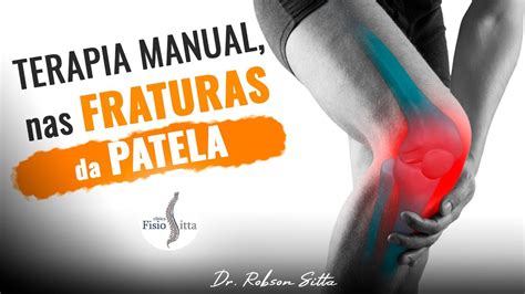 Fratura Da Patela Fisioterapia Do Joelho Tratamento Completo Terapia