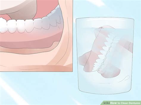 How to Clean Dentures: 13 Steps (with Pictures) - wikiHow