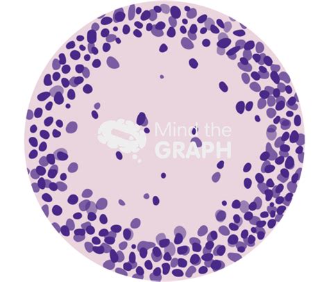 Tissue histology granuloma zoom