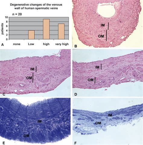 The Complex Structure Of The Smooth Muscle Layer Of Spermatic Veins And