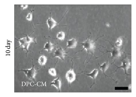 Dpc Cm Stimulated Neuron Like Differentiation Of Pc Cells A Rt Pcr