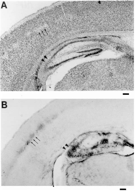 Representative photomicrographs through cortex and hippocampus ... 