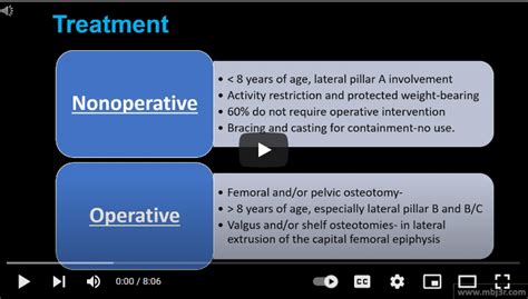 Perthes Disease Hip – MBJ Clinic – Bone & Joint : Orthopedic Clinic