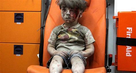 As Est Ahora Omran Daqneesh El Ni O S Mbolo De La Guerra En Siria