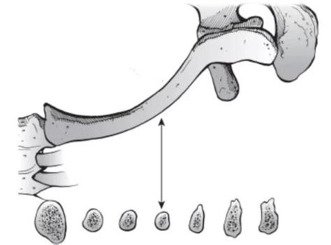 Clavicle Anatomy | Bone & Muscles by Orthofixar - Issuu